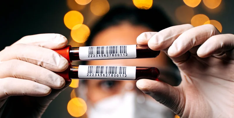 渔业劳动者手部特写,展示皮肤状