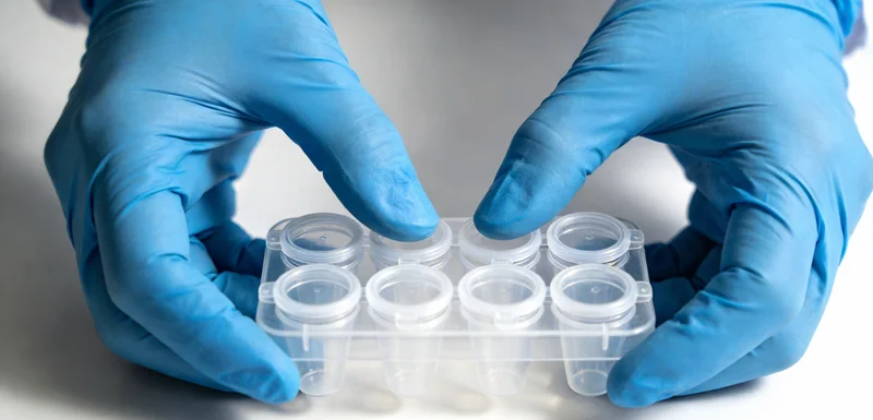 从样本采集到报告生成的完整mN