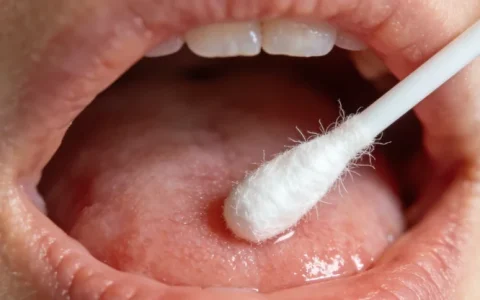 秦皇岛肺癌基因检测的靠谱机构