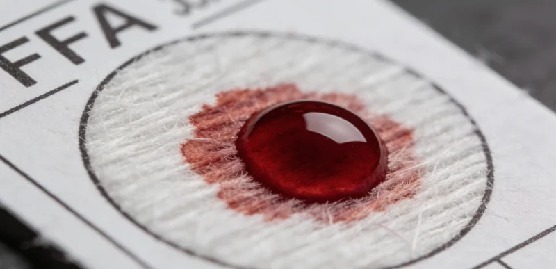 医护人员正在为检测者进行静脉血