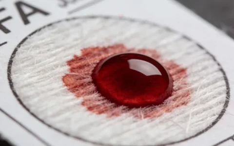 宜春脑脊液mNGS基因检测公司怎么选？2026年挑选指南与避坑建议