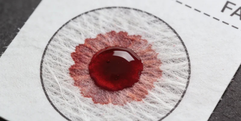 护士正在为患者进行鼻咽拭子采样