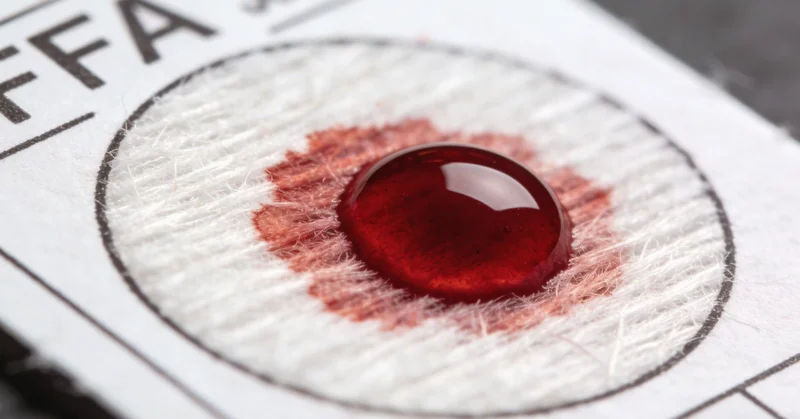 规范采集深部痰液样本放入无菌容