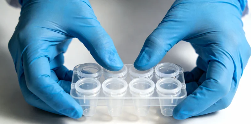 病毒基因检测从采样到报告的全流