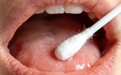 宜春脑肿瘤基因检测合法机构