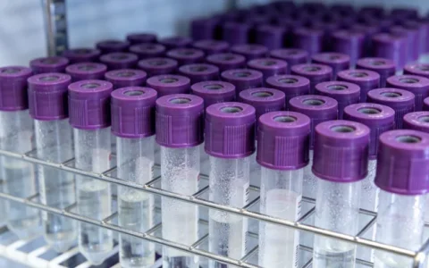 临汾脓毒症病原基因检测公司有哪些