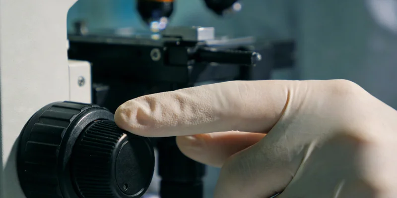 电脑屏幕上显示的微生物检测分析