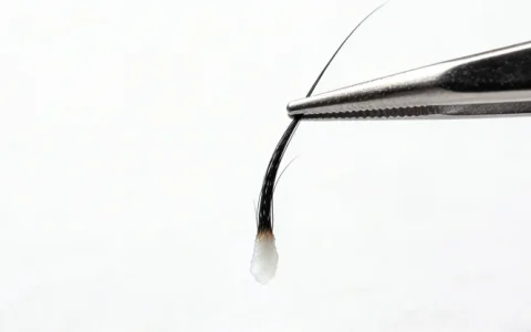 延边州甲状腺癌基因检测机构地址