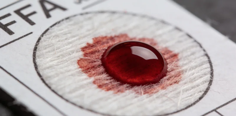 医护人员正在无菌操作下采集血液