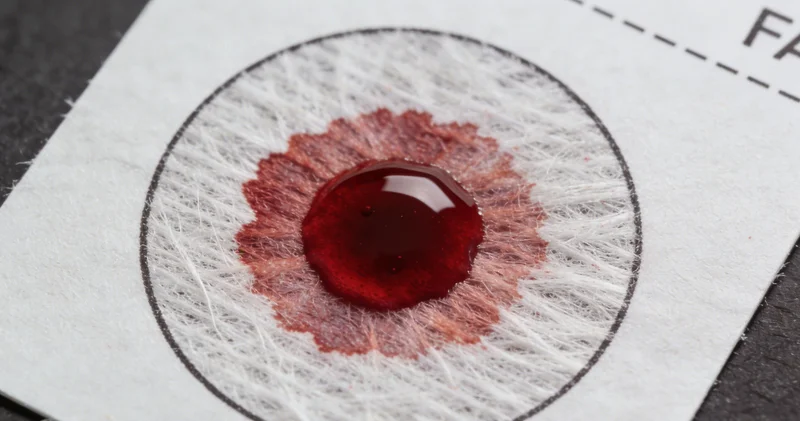 医疗人员正在进行支气管肺泡灌洗