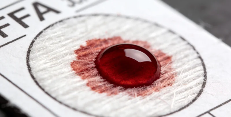 规范使用采样管采集粪便样本的步