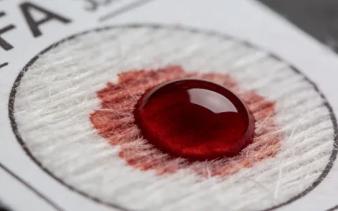 宝鸡食管癌基因检测机构更新5家名录及2026年地址归纳