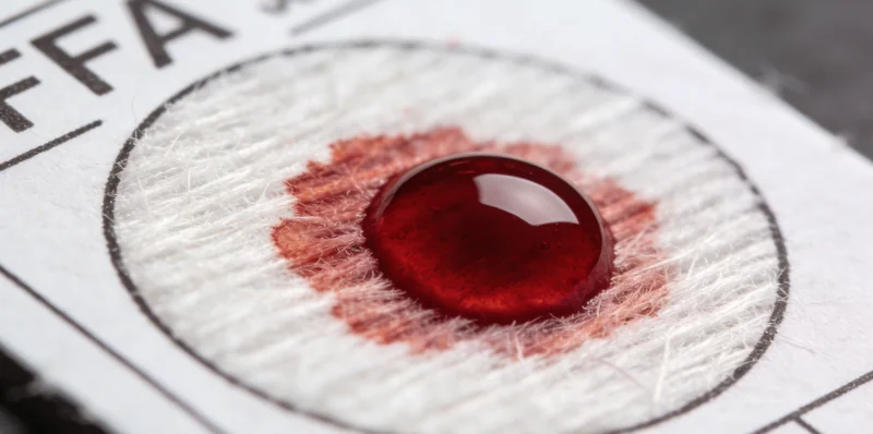 宏基因组检测四步流程分解图