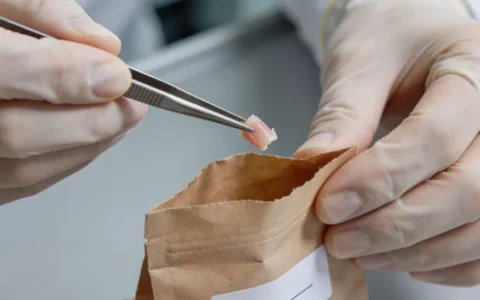 楚雄膀胱癌基因检测正规机构电话地址