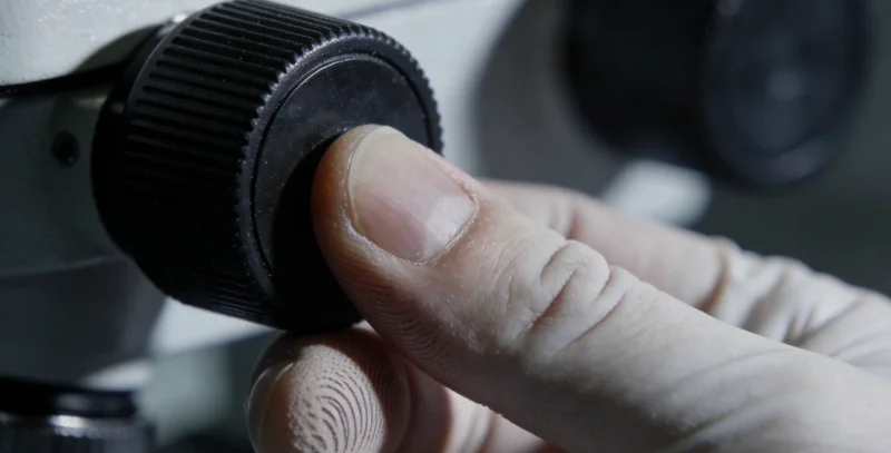 医生在灯箱前查看肺部CT影像,