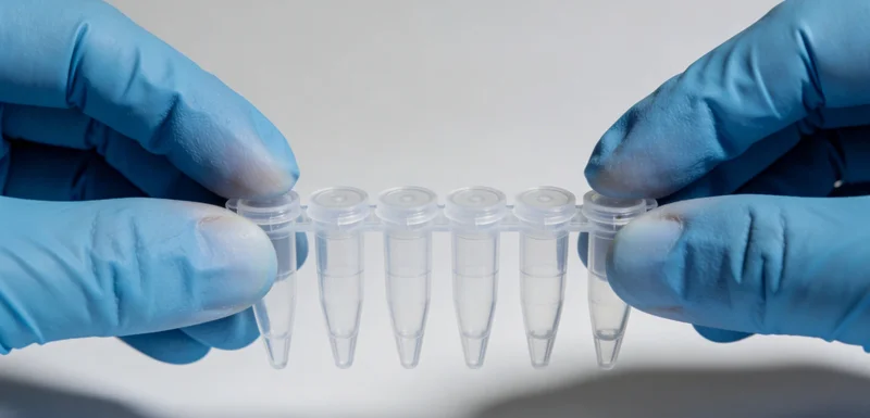 朔州患者咨询脑胶质瘤基因检测场景