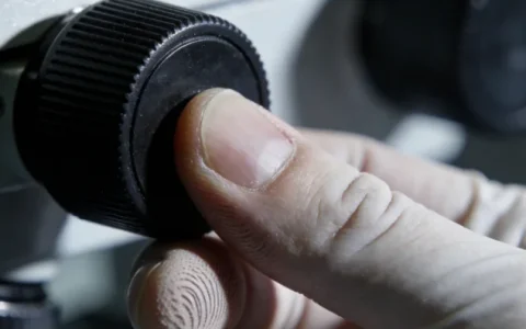 贵阳脓毒症病原基因检测哪家靠谱？最新正规机构名单与避坑要点