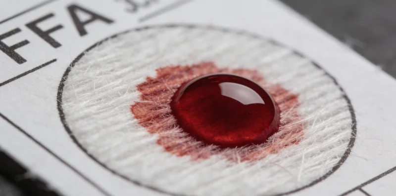 医护人员指导痰液样本采集过程