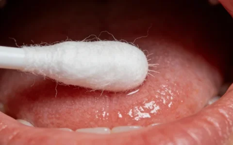 安庆卵巢癌基因检测机构全新5家名单及2026年地址总览