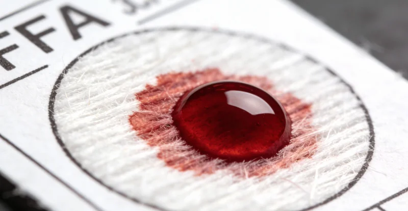 医生在无菌操作下进行腹腔穿刺抽