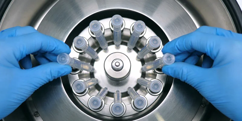 南通医院神经外科医生正在查看脑部影像资料