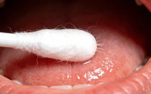 南昌肺癌基因检测机构去哪查？