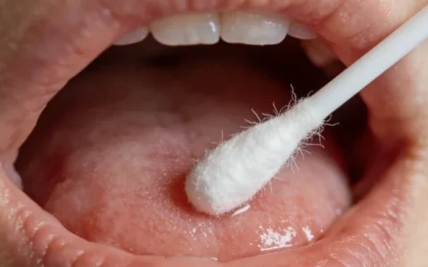 鹰潭PCR病原基因检测检测中心