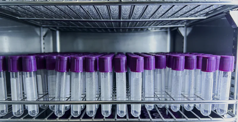 医生在灯箱前查看腹腔影像片,表