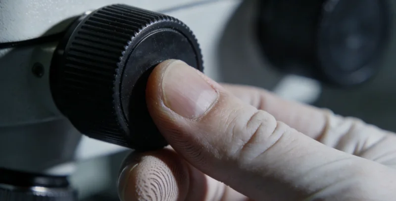 医生正在显微镜前专注观察脑脊液