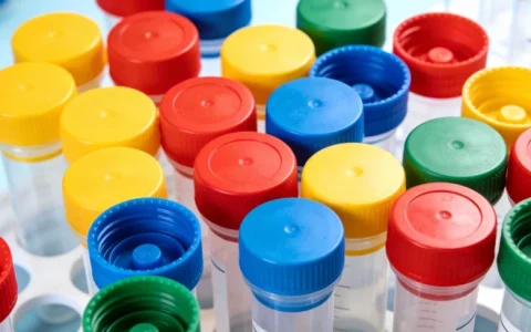 哈尔滨膀胱癌基因检测办理地址查询