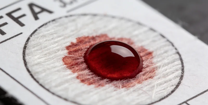 医护人员进行咽拭子样本采集