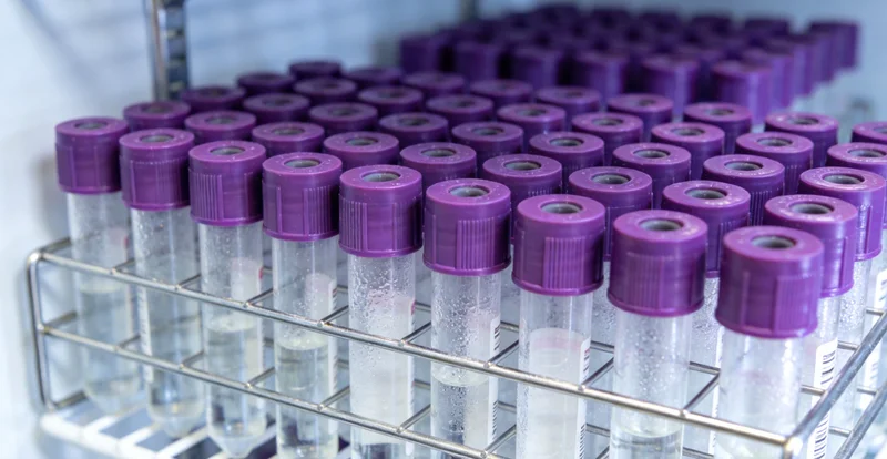 专业人员进行健康检测咨询指导