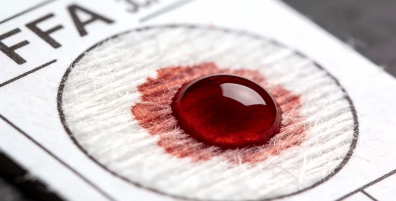 护士正在为患者进行静脉采血,样