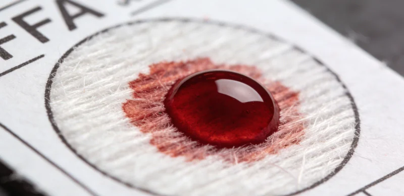 技术人员正在进行血液样本的EB