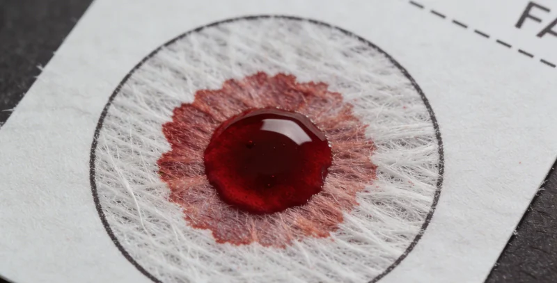 医生正在与患者家属讨论胸部影像