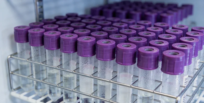 一位中老年女性在林地中劳作,面