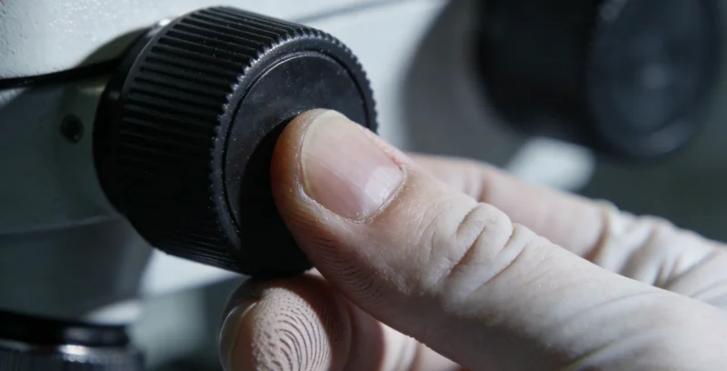 医生在办公室内共同讨论腹腔积液