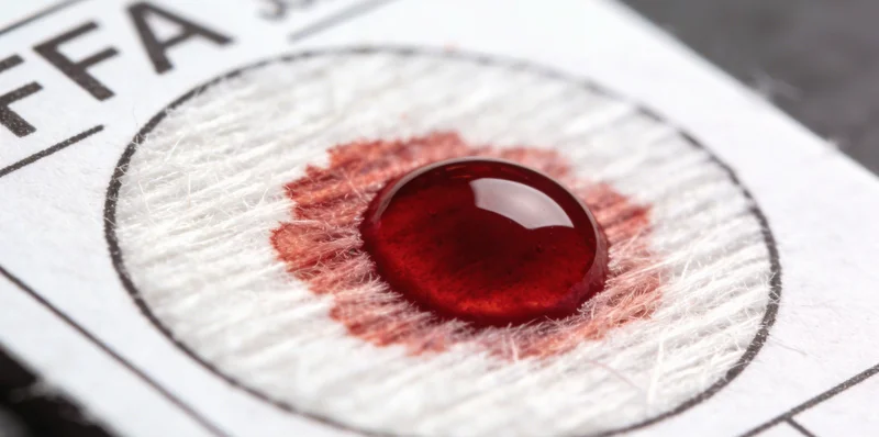 医护人员正在使用专业拭子进行无