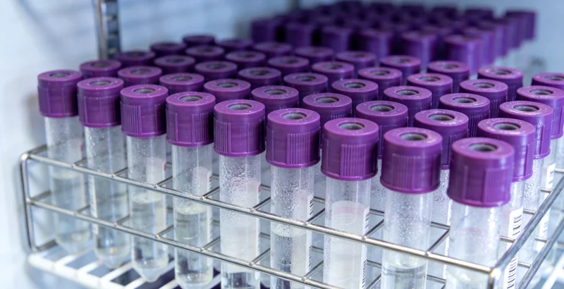 象征健康生活的蔬果、运动器材与