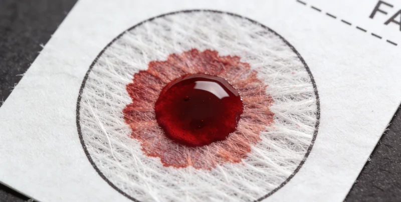 电子显微镜下的隐球菌形态展示,