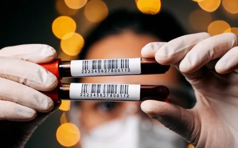 黄石真菌基因检测机构在哪里？