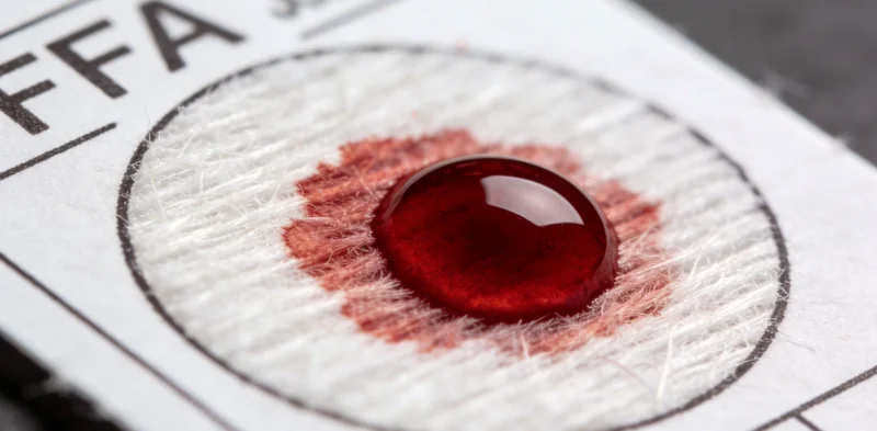 规范化的医学采样操作示意