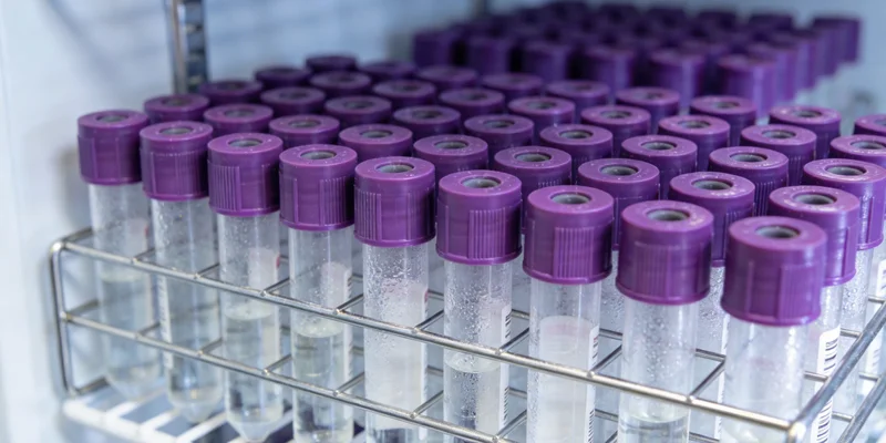 mNGS检测原理示意图:展示从