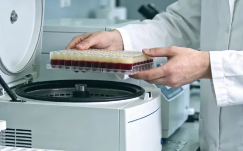 广安耳聋伴高度近视基因检测机构精选:3家优质名单与选择指南