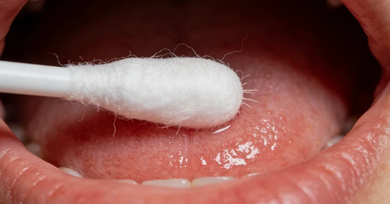 医生正在为患者进行支气管镜检查