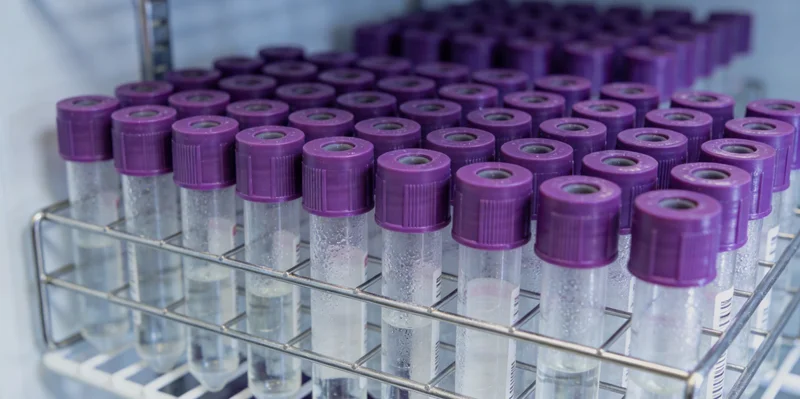 一位威海准妈妈在查看产检报告,