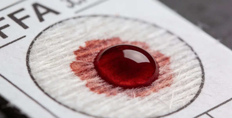 特写:带有保存液的专用粪便样本