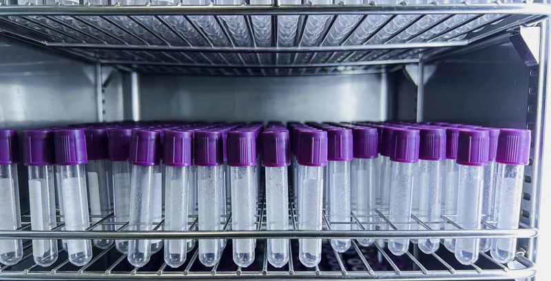 单纯疱疹病毒（HSV）在电子显