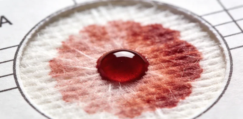 医护人员正在规范采集血液样本，