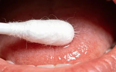 百色HSV基因检测哪家最准